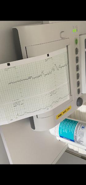 Bild zu Übungswehen auf CTG - Schwanger - wer noch? Rund um die Schwangerschaft