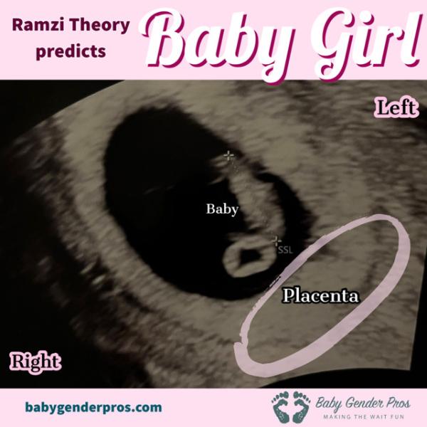 Bild zu Erfahrungen Ramzi (Baby Gender Pros) - Schwanger - wer noch? Rund um die Schwangerschaft