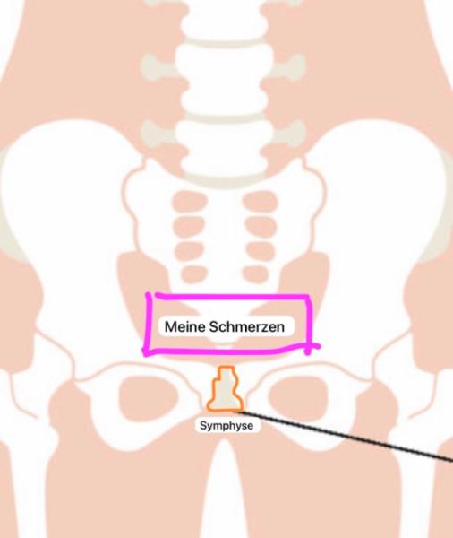Bild zu Dauerhafter Druck/Schmerz im Unterleib!! - Schwanger - wer noch? Rund um die Schwangerschaft