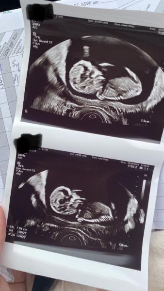 Bild zu Geschlecht?? Erkennen?? - Schwanger - wer noch? Rund um die Schwangerschaft