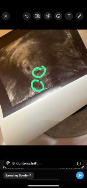 Bild zu Anfang 5ssw - Schwanger - wer noch? Rund um die Schwangerschaft
