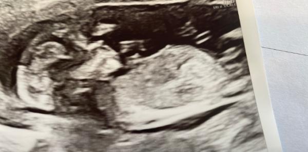 Bild zu Nub Theorie - Schwanger - wer noch? Rund um die Schwangerschaft
