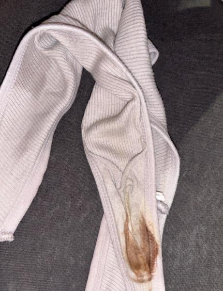 Bild zu Schmierblutung - Schwanger - wer noch? Rund um die Schwangerschaft