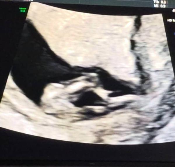 Bild zu Junge oder Mädchen - Schwanger - wer noch? Rund um die Schwangerschaft