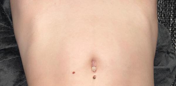 Bild zu Linea Nigra? - Schwanger - wer noch? Rund um die Schwangerschaft