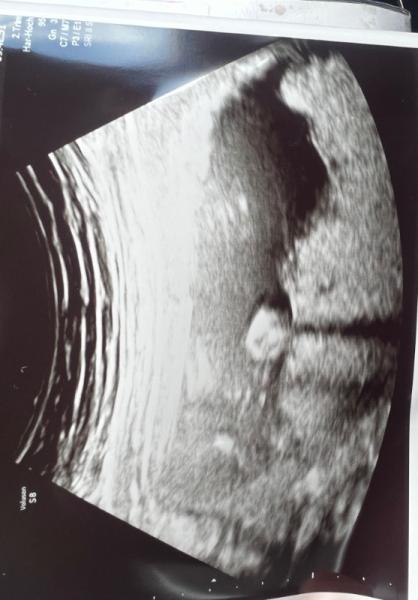 Bild zu Geschlecht 16.ssw - Schwanger - wer noch? Rund um die Schwangerschaft
