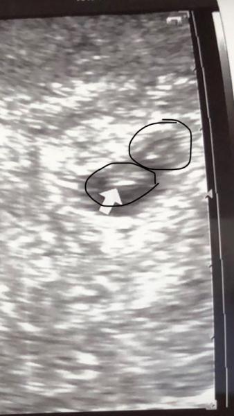 Bild zu Zwillinge? - Schwanger - wer noch? Rund um die Schwangerschaft
