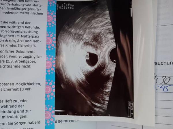 Bild zu