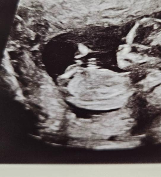 Bild zu Nub-Theorie - Schwanger - wer noch? Rund um die Schwangerschaft