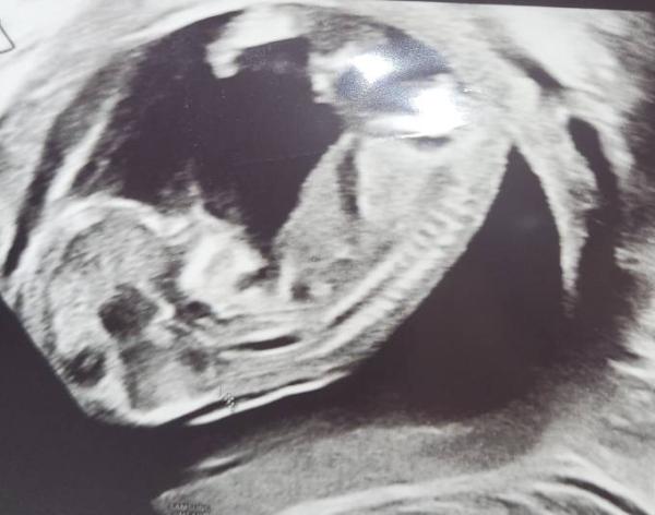 Bild zu Baby Geschlecht erahnen - Schwanger - wer noch? Rund um die Schwangerschaft