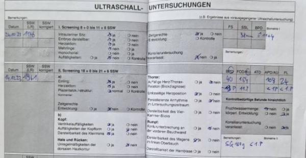 Bild zu Helft mir 😱 Kind zu klein, Feindiagnostik - Schwanger - wer noch? Rund um die Schwangerschaft