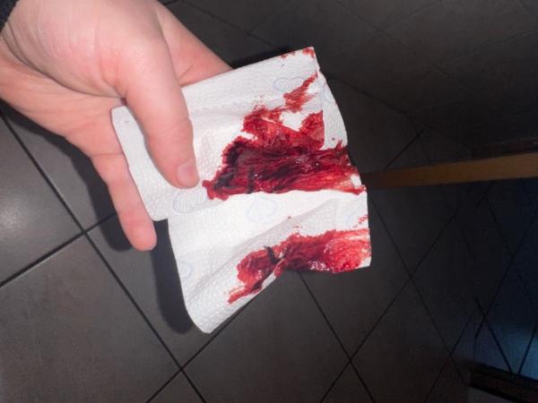 Bild zu Periode nach AS nur blut und stark - Schwanger - wer noch? Rund um die Schwangerschaft