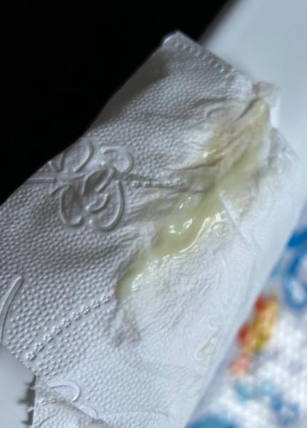 Bild zu Schleimpropf oder Teil vom schleimpropf !! Achtung Bild!! - Schwanger - wer noch? Rund um die Schwangerschaft