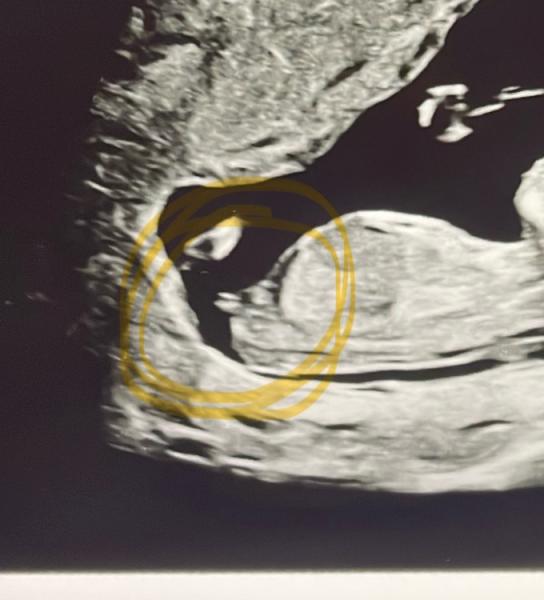Bild zu Geschlecht - Schwanger - wer noch? Rund um die Schwangerschaft