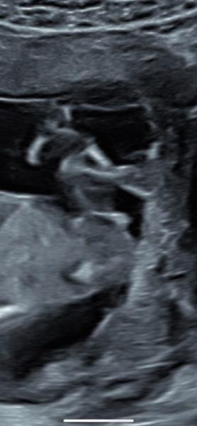 Bild zu Erkennt jemand einen Hinweis auf das Geschlecht ? - Schwanger - wer noch? Rund um die Schwangerschaft