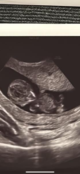 Bild zu Mädchen oder Bub? - Schwanger - wer noch? Rund um die Schwangerschaft