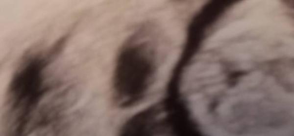 Bild zu Jungentendenz 11+2? Sicher? - Schwanger - wer noch? Rund um die Schwangerschaft