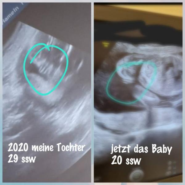 Bild zu Gern vergleichen und raten! Mädchen oder Junge? - Schwanger - wer noch? Rund um die Schwangerschaft