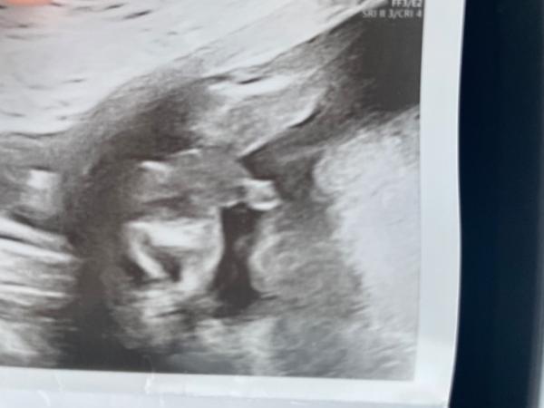 Bild zu Junge?? - Schwanger - wer noch? Rund um die Schwangerschaft