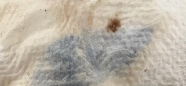 Bild zu Ängste - Schwanger - wer noch? Rund um die Schwangerschaft