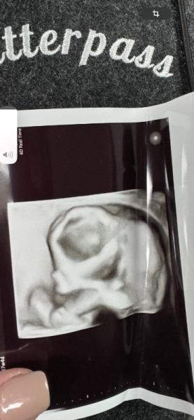 Bild zu Größe embryo - Schwanger - wer noch? Rund um die Schwangerschaft