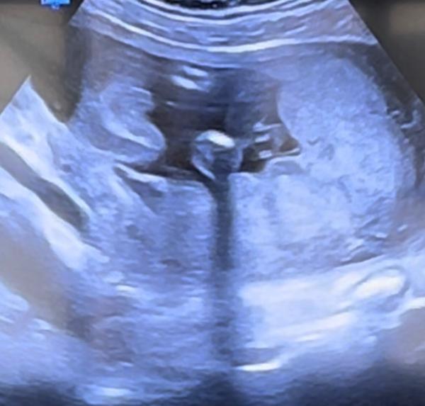 Bild zu Geschlecht erraten - Schwanger - wer noch? Rund um die Schwangerschaft