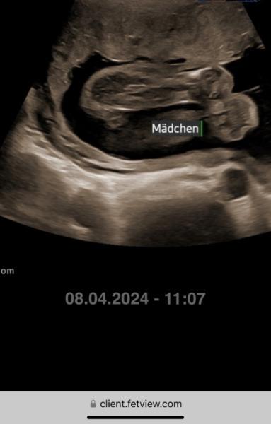 Bild zu Junge oder mädchen - Schwanger - wer noch? Rund um die Schwangerschaft