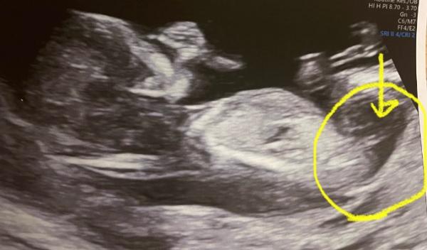 Bild zu Geschlecht? - Schwanger - wer noch? Rund um die Schwangerschaft