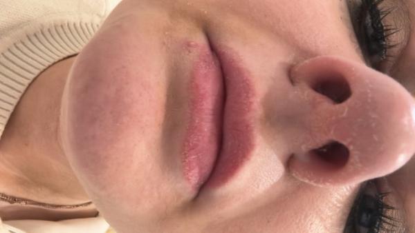Bild zu