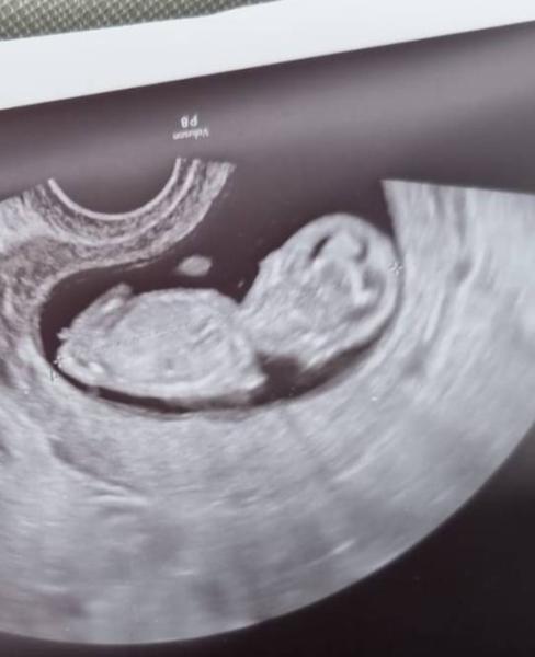 Bild zu Nub - was denkt ihr? - Schwanger - wer noch? Rund um die Schwangerschaft