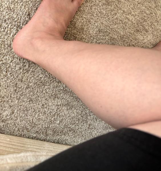 Bild zu Thrombose? - Schwanger - wer noch? Rund um die Schwangerschaft
