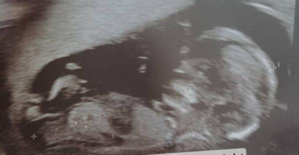 Bild zu 3 termin fa super - Schwanger - wer noch? Rund um die Schwangerschaft