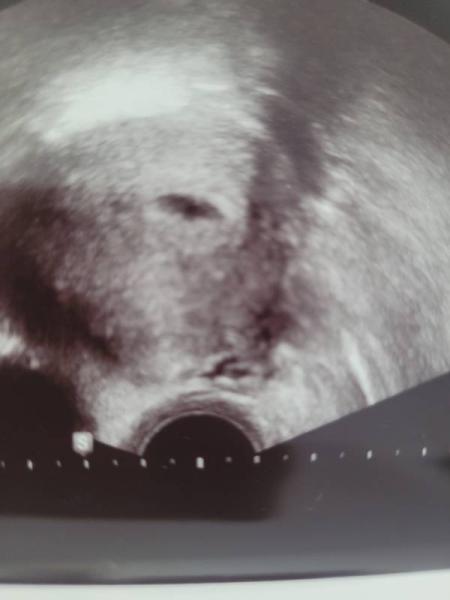 Bild zu 1. SS - nach Termin verunsichert - Schwanger - wer noch? Rund um die Schwangerschaft