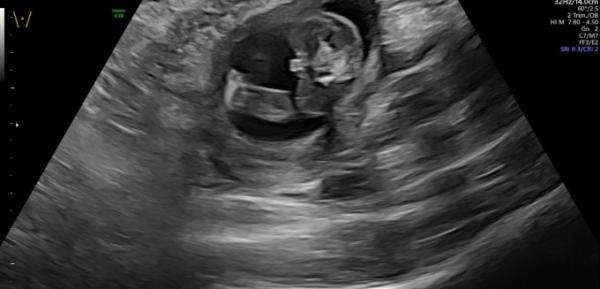 Bild zu Was meint ihr Geschlecht 16+6 ssw :) - Schwanger - wer noch? Rund um die Schwangerschaft