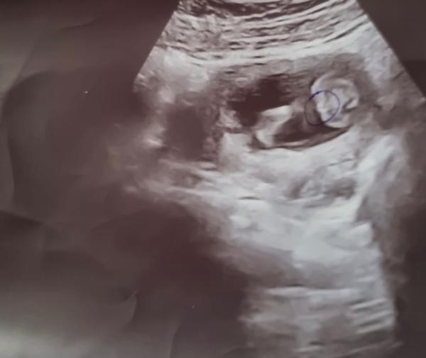 Bild zu Junge oder Mädchen? - Schwanger - wer noch? Rund um die Schwangerschaft