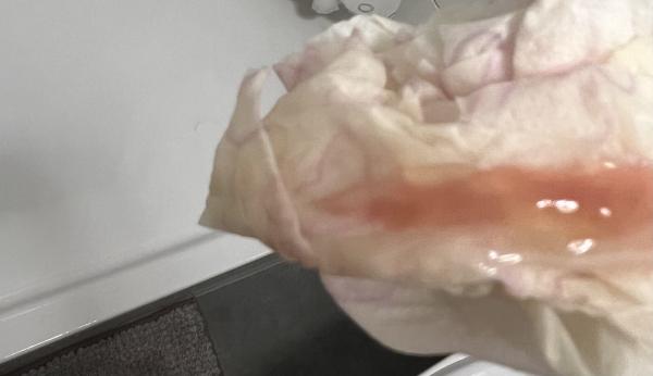 Bild zu Ist das der Schleimpropf? - Schwanger - wer noch? Rund um die Schwangerschaft