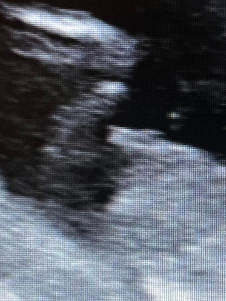Bild zu Nub theorie - Schwanger - wer noch? Rund um die Schwangerschaft
