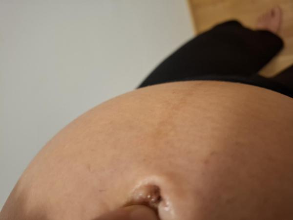 Bild zu Bauchnabel sieht blutig aus - Schwanger - wer noch? Rund um die Schwangerschaft