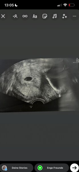 Bild zu Welches Geschlecht nach Ramzi Methode ❤️🩵 - Schwanger - wer noch? Rund um die Schwangerschaft