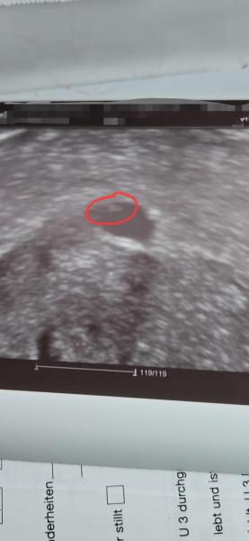 Bild zu Windei / Eckenhocker ? - Schwanger - wer noch? Rund um die Schwangerschaft