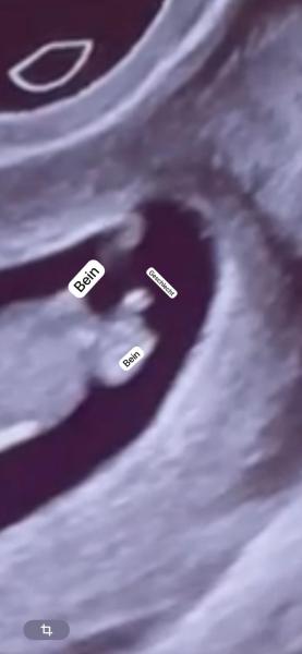 Bild zu Was sagt ihr ? - Schwanger - wer noch? Rund um die Schwangerschaft