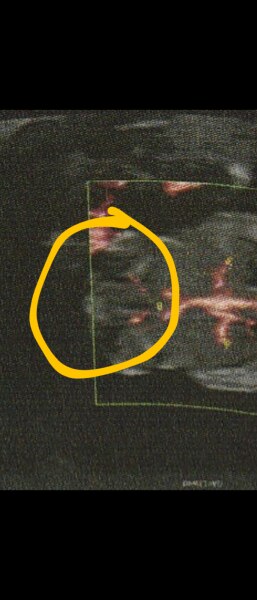 Bild zu 14 SSW - Junge oder Mädchen? - Schwanger - wer noch? Rund um die Schwangerschaft