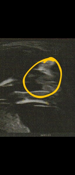 Bild zu 14 SSW - Junge oder Mädchen? - Schwanger - wer noch? Rund um die Schwangerschaft