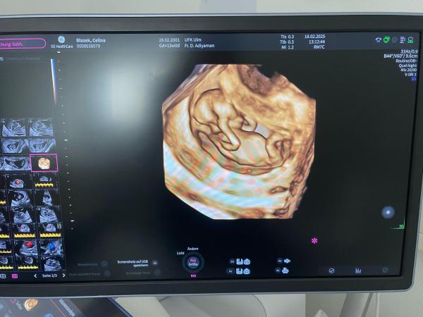 Bild zu Mädchen oder junge - Schwanger - wer noch? Rund um die Schwangerschaft