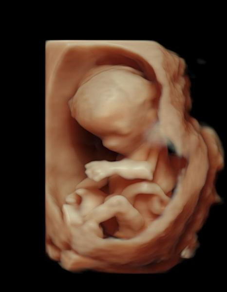 Bild zu Mädchen oder Junge??? SSW 14 - Schwanger - wer noch? Rund um die Schwangerschaft