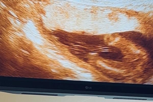 Bild zu Junge oder Mädchen? - Schwanger - wer noch? Rund um die Schwangerschaft