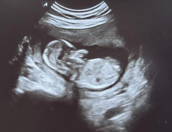 Bild zu Junge oder Mädchen? - Schwanger - wer noch? Rund um die Schwangerschaft