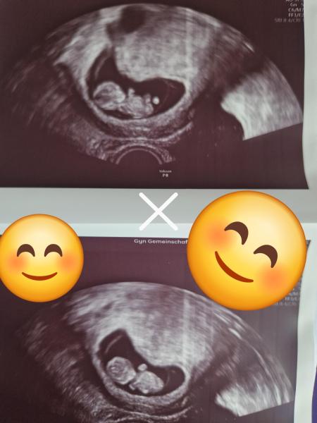 Bild zu Boy or Girl? - Schwanger - wer noch? Rund um die Schwangerschaft