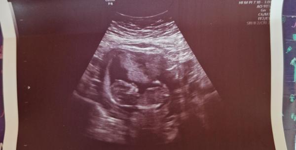 Bild zu Boy or Girl? - Schwanger - wer noch? Rund um die Schwangerschaft