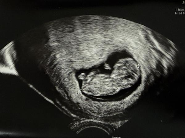 Bild zu Junge oder Mädchen? - Schwanger - wer noch? Rund um die Schwangerschaft